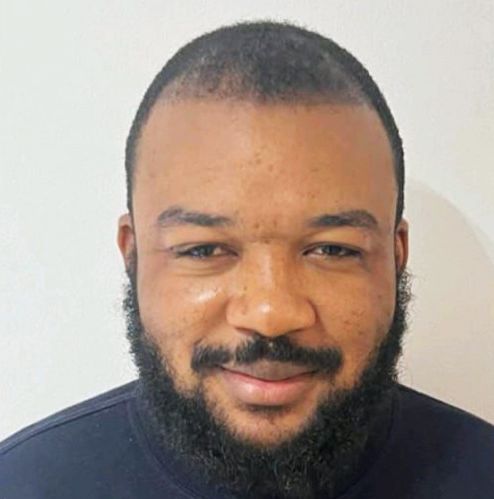 Hair Restoration -  Treatment